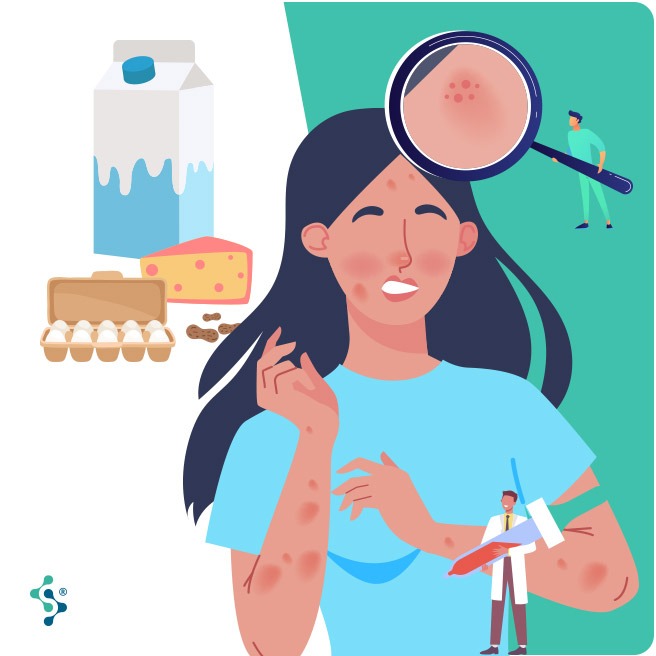 Panel alergias - Crystal Med